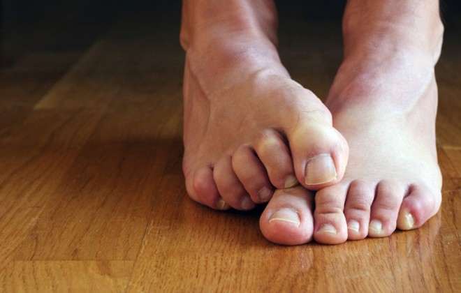 Fáj, érzékeny, vagy görcsölni szokott valamelyik a lábujjad? Nézd meg, milyen betegségre utal!